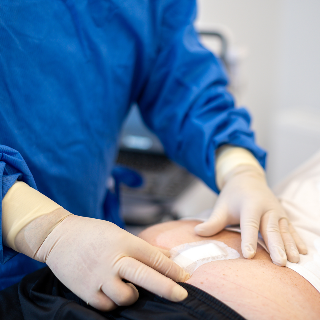 Recommendations after the procedure - PILONIDAL CLINIC